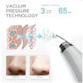 6 in 1 Blackhead Remover – USB Rechargeable Pore & Acne Cleaner